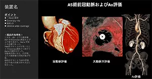 2025Cardiovascular_08_01