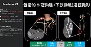 2025Cardiovascular_10_01