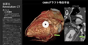 2025Cardiovascular_12_01