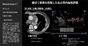 2025Cardiovascular_14_01