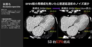 2025Cardiovascular_15_01