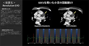 2025Cardiovascular_16_01
