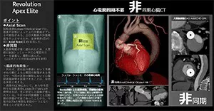 2025Cardiovascular_17_01