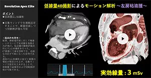 2025Cardiovascular_18_01
