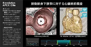 2025Cardiovascular_19_01