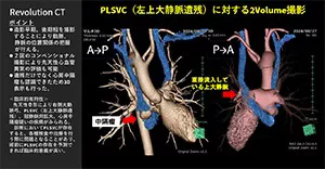 2025Cardiovascular_20_01