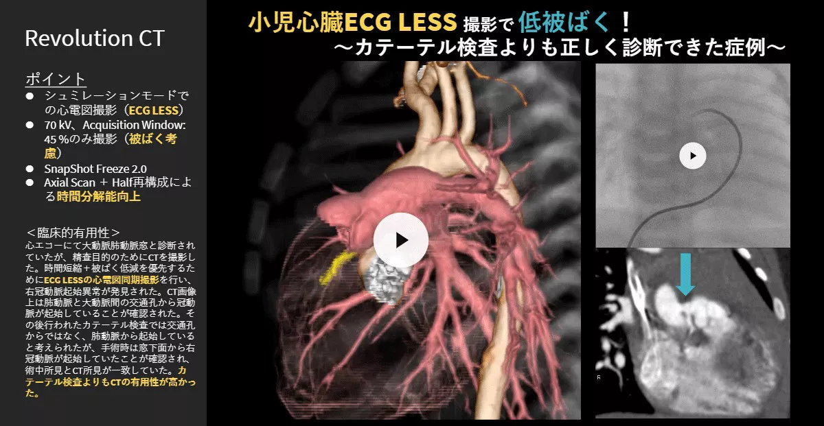 2026Cardiovascular_01_01