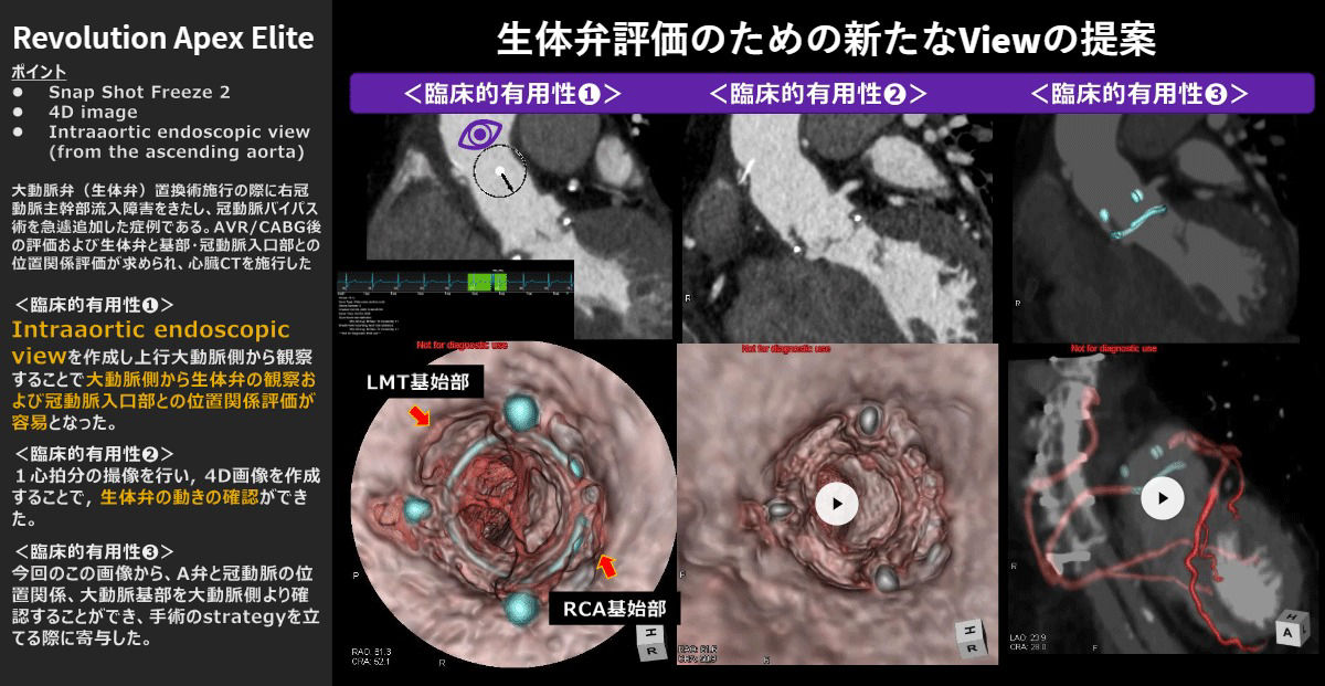 2026Cardiovascular_02_01