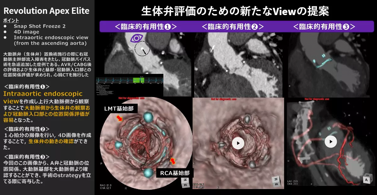 2026Cardiovascular_02_01