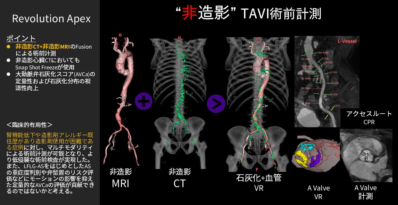 2026Cardiovascular_05_01