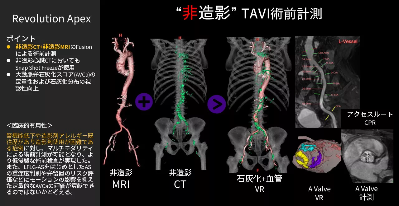 2026Cardiovascular_05_01