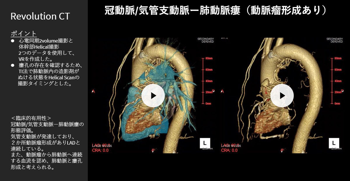 2026Cardiovascular_06_01