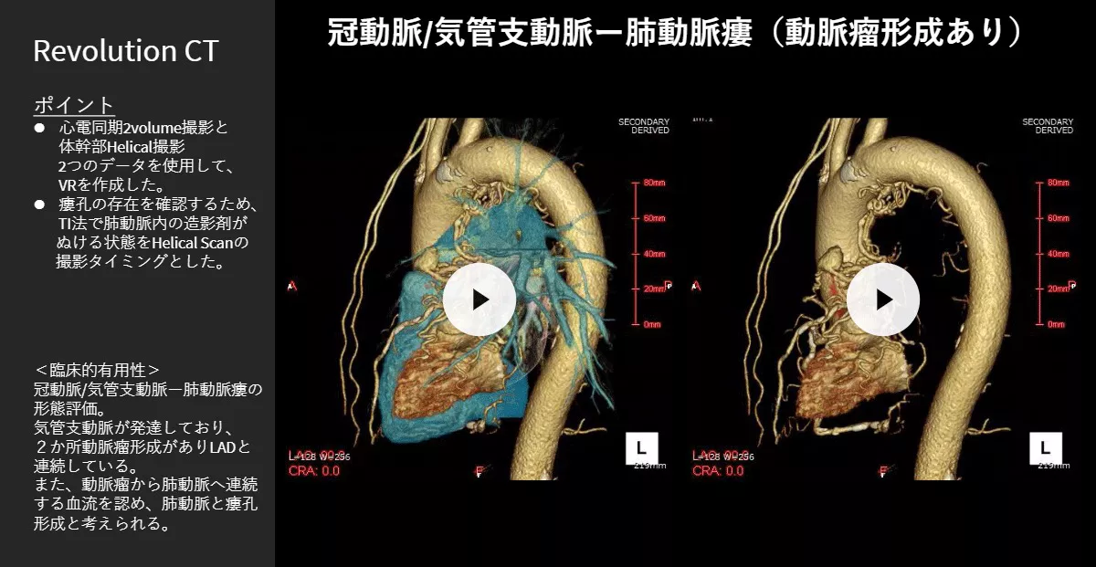 2026Cardiovascular_06_01