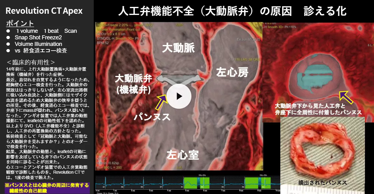 2026Cardiovascular_07_01