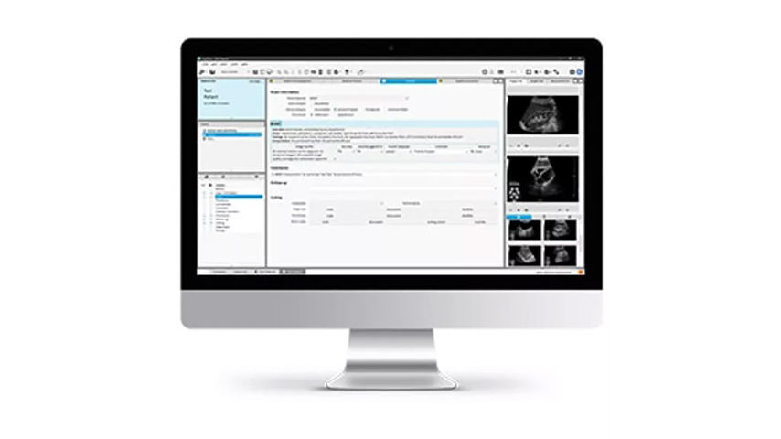 222_WTBUDGEHC_Feature_Card_half_3