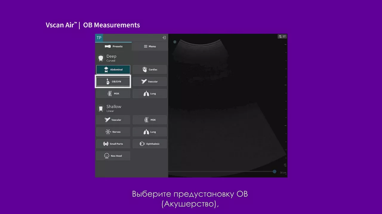 23089-vscan tutorials-ob-measurements-v2