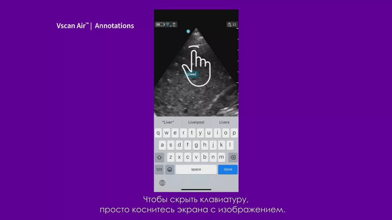 23089-vscan-tutorials-annotations-v1