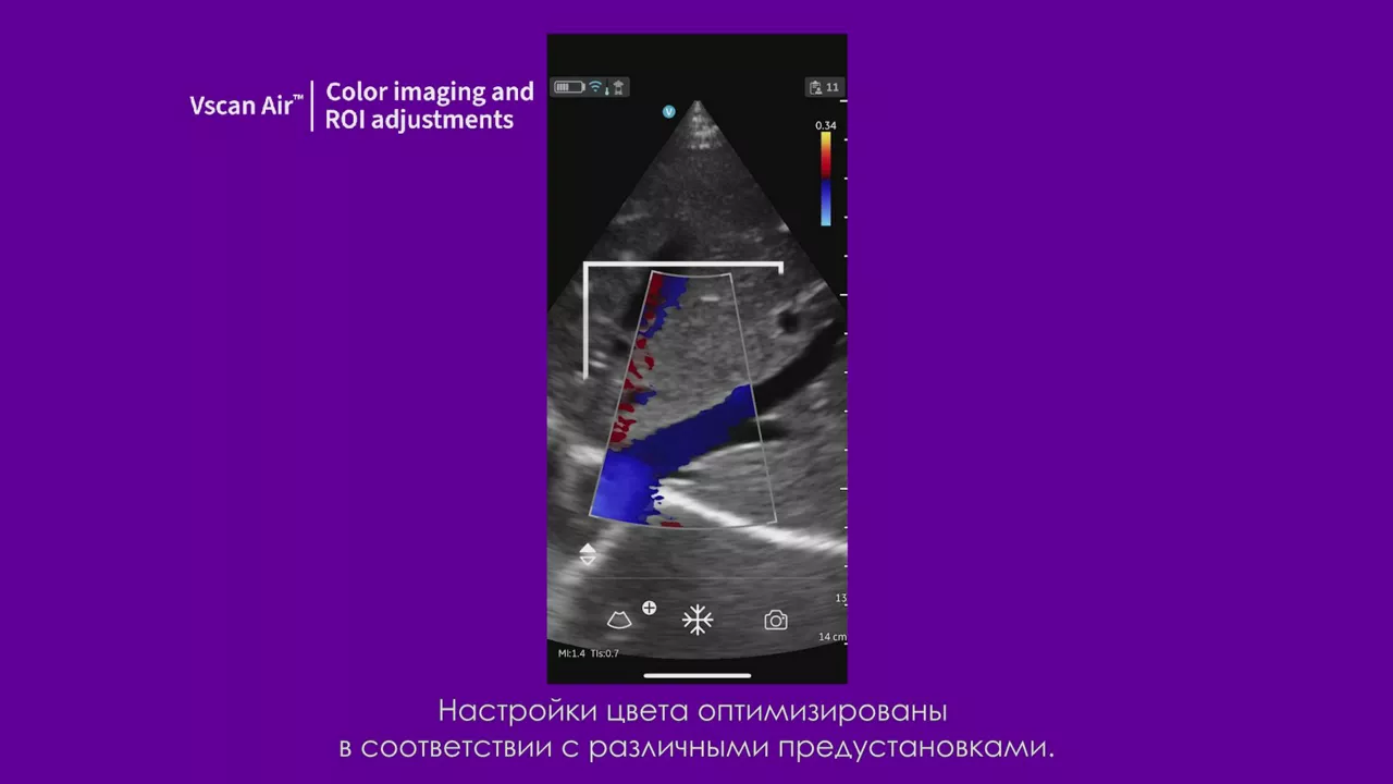 23089-vscan-tutorials-color-imaging-and-roi-adjustments-v1-1