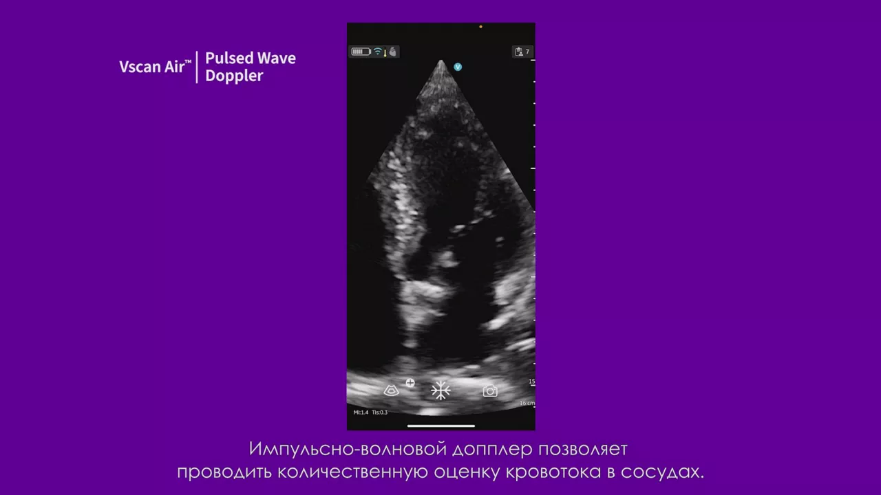 23089-vscan-tutorials-pulsed-wave-spectral-doppler-v2
