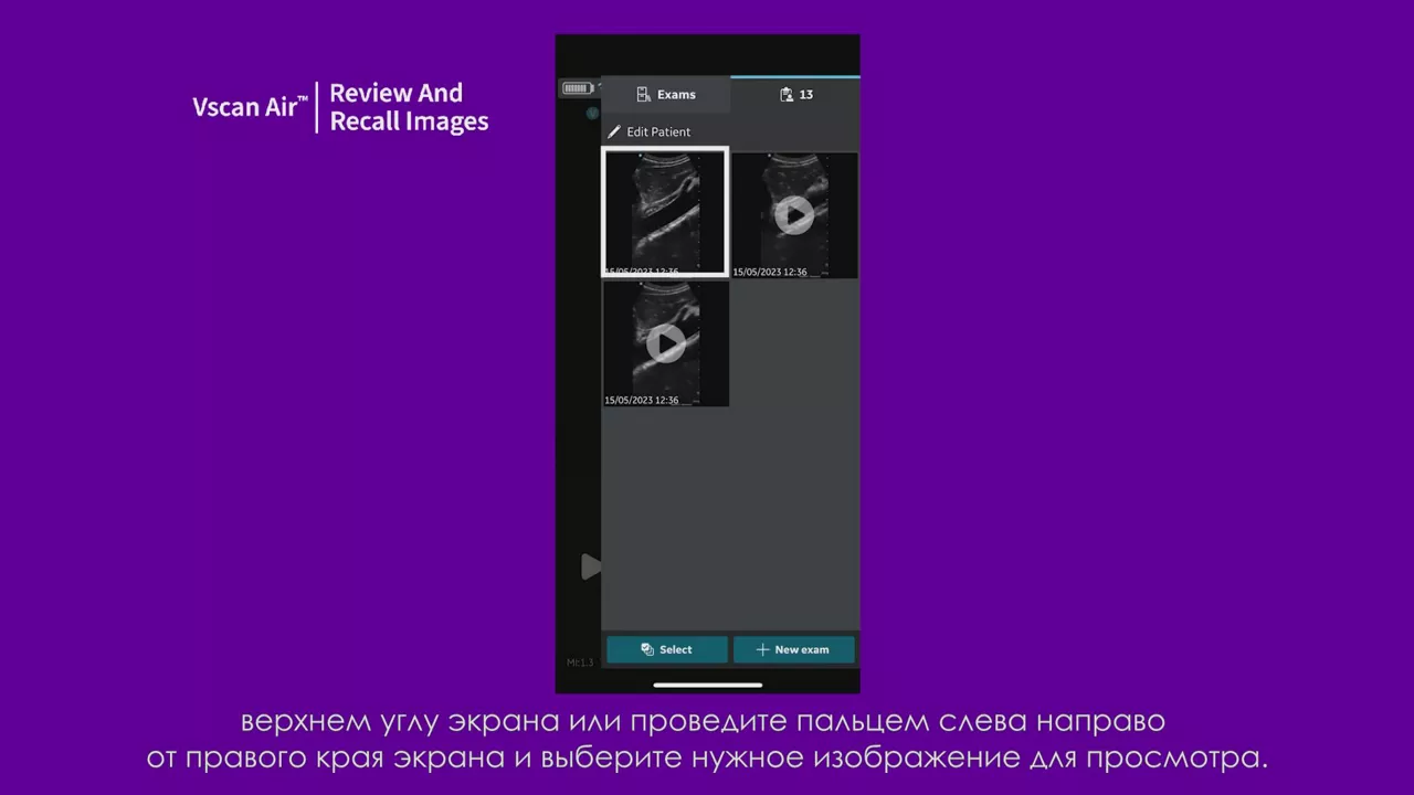 23089-vscan-tutorials-review-and-recall-images-v2
