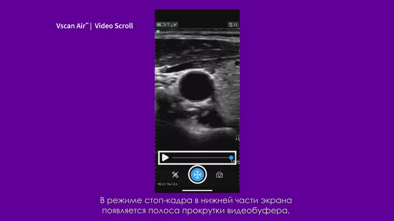 23089-vscan-tutorials-video-scroll-v2