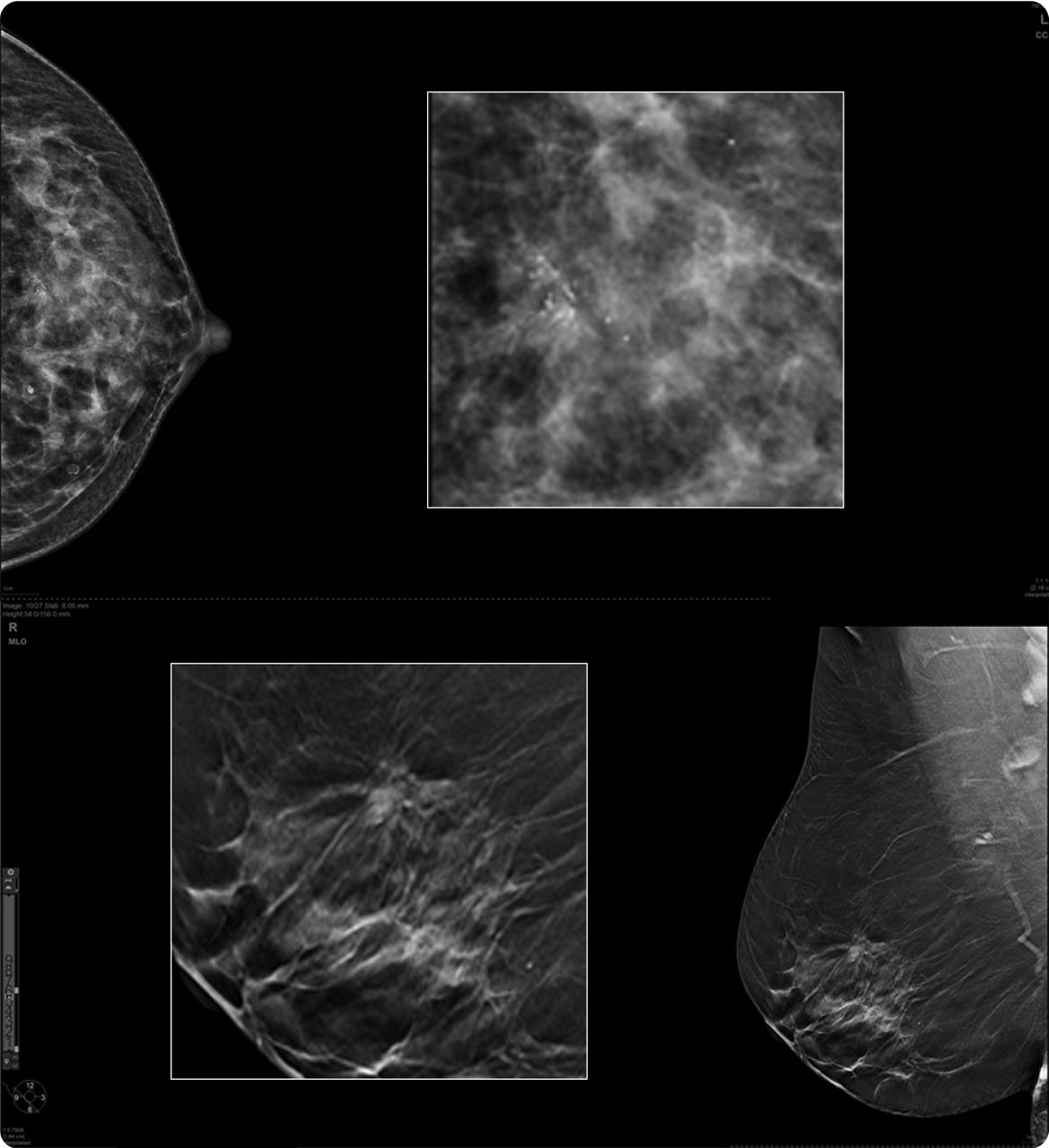 2324-pristina-duo-webpage-feature-3