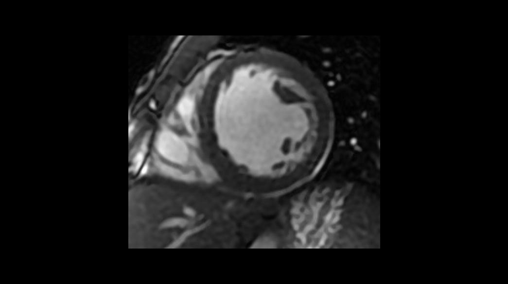 2D-FIESTA-Cine1040-x-585