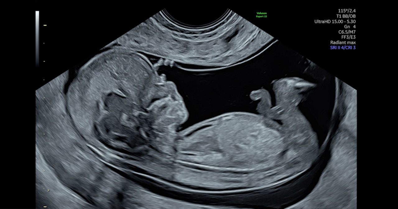 2D-Image-Quality_Desktop