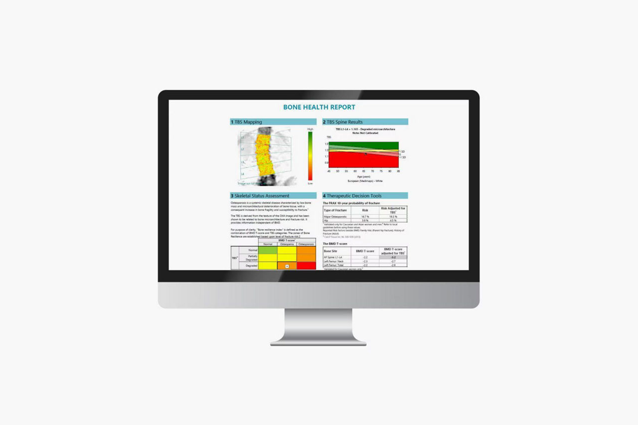 3-advancements-in-ba-en