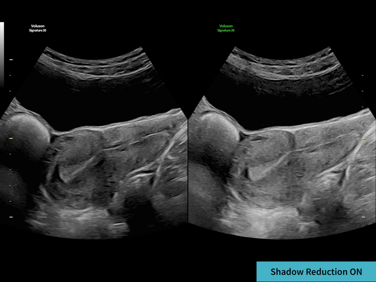 3-augment-image