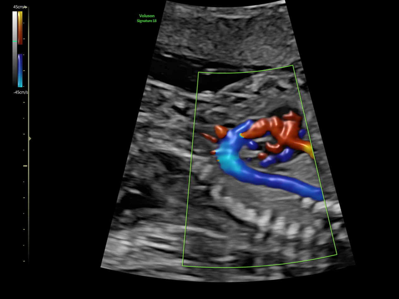 3-radiantflow-clinical-image
