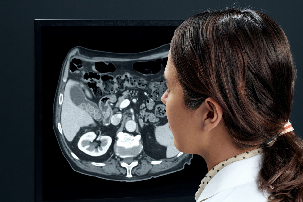 3-revolution-altitude-feature-hero