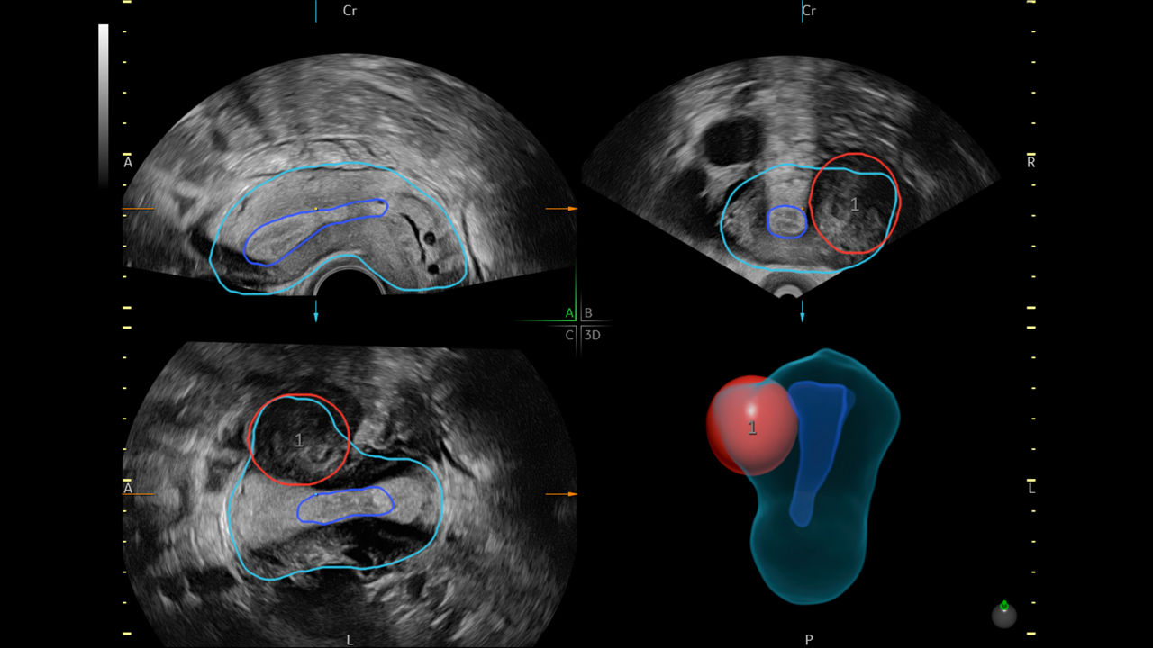 3-sonogyn