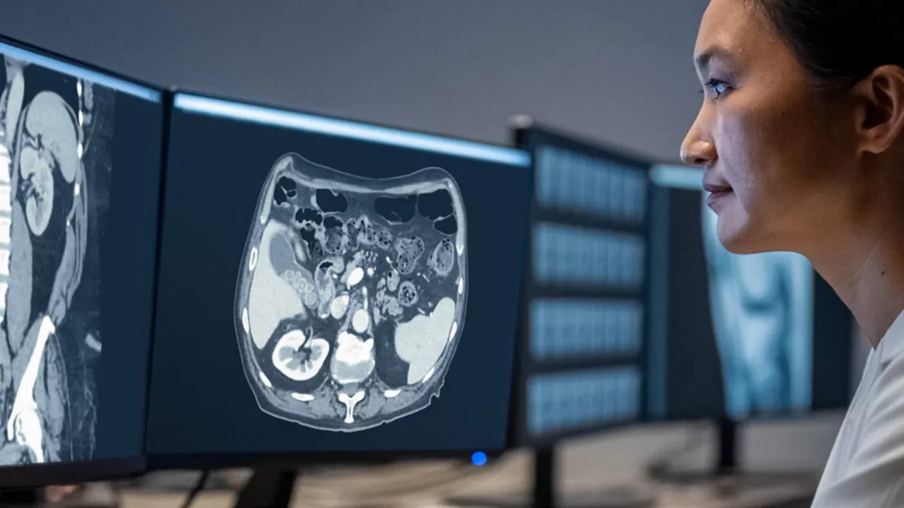 3-truefidelity-ct-image-reconstruction-low-noise