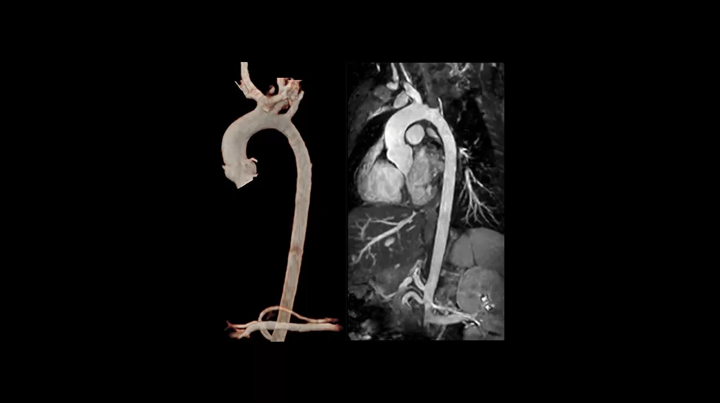 3D-Heart1040-x-585