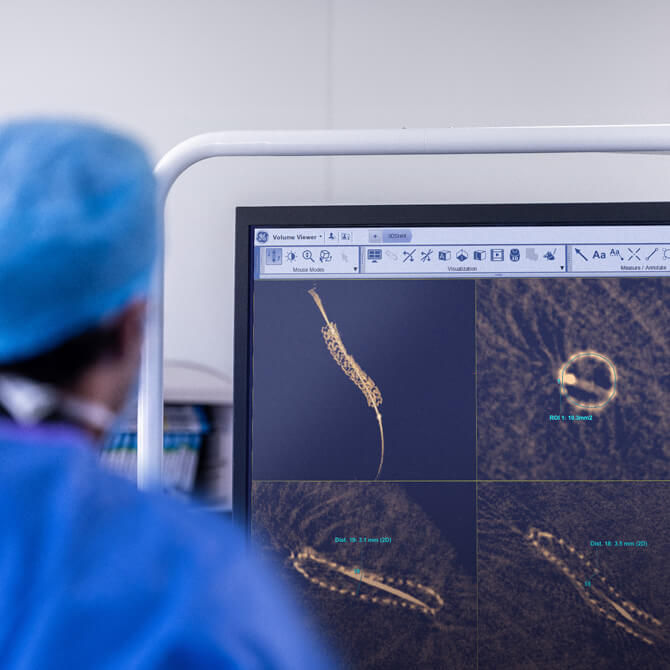 4 quadrant images of 3DStent