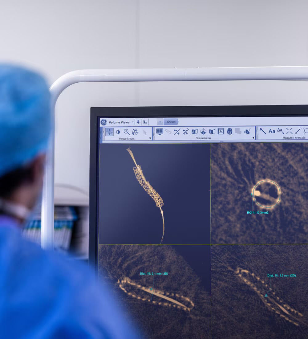 3dstent-sticky-easy-image-ci-en