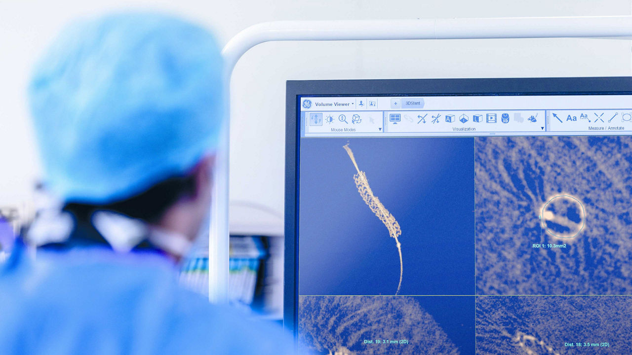 ECG cables and lead wires.