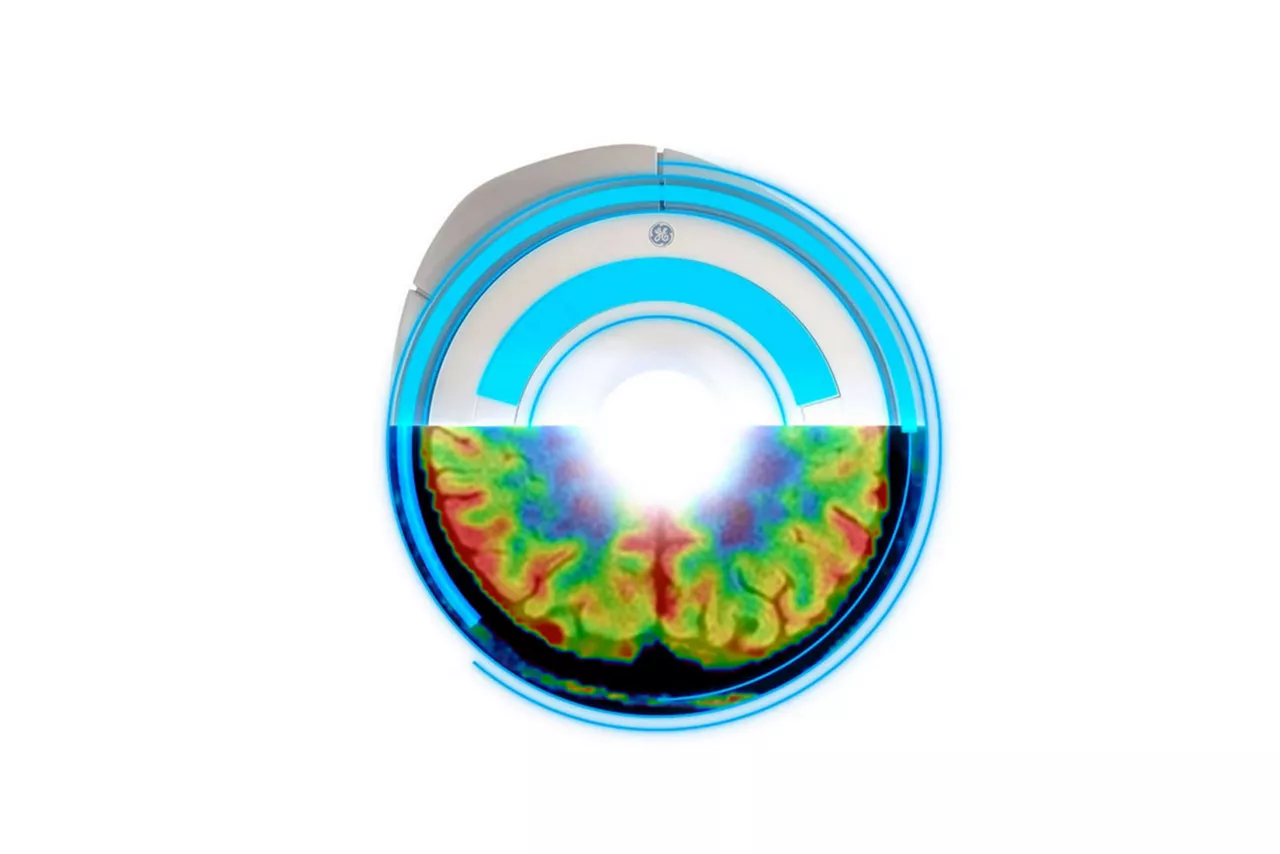 3t-mri-scanners--HeroSticky-ci-en copy 3