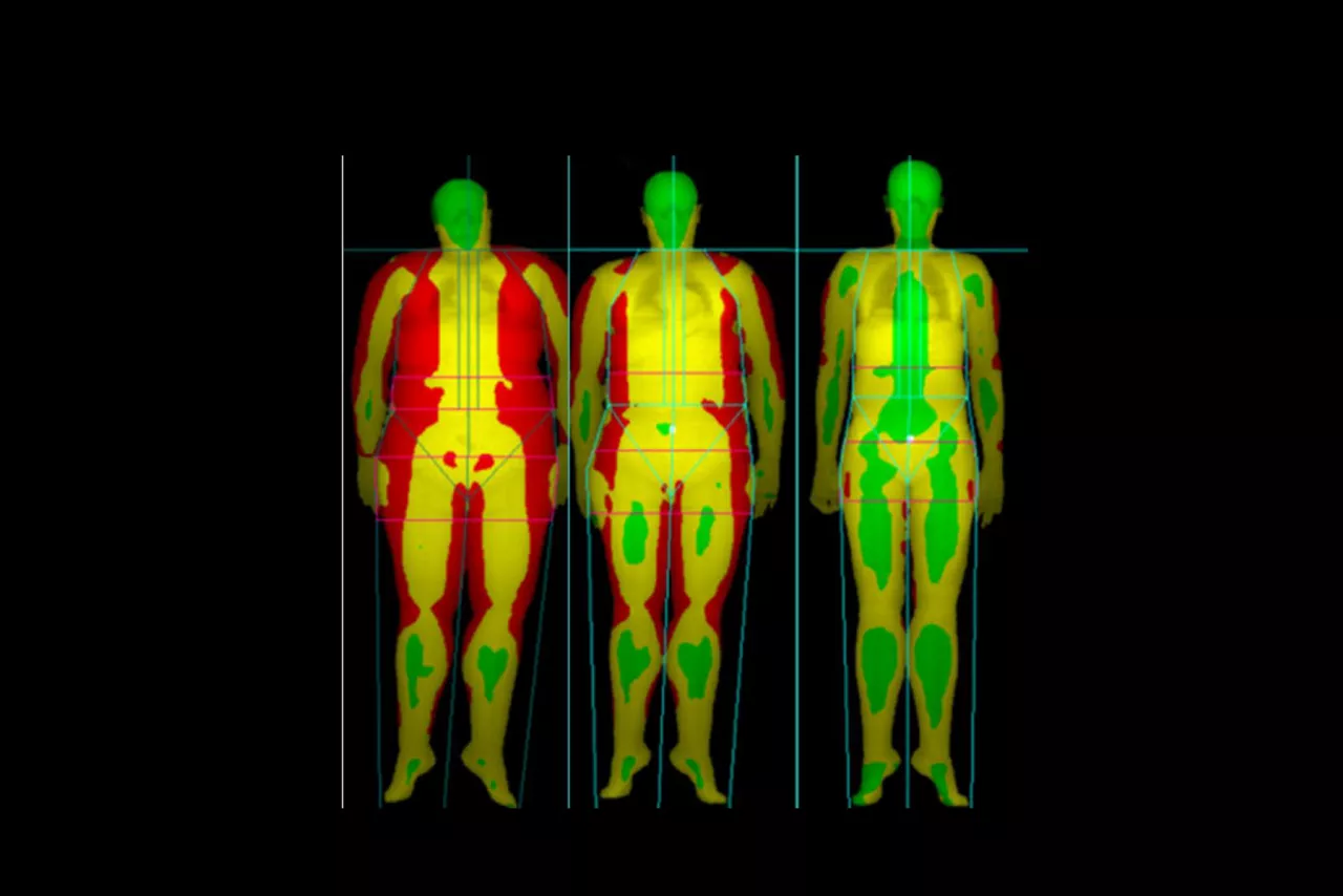 4-body-composition