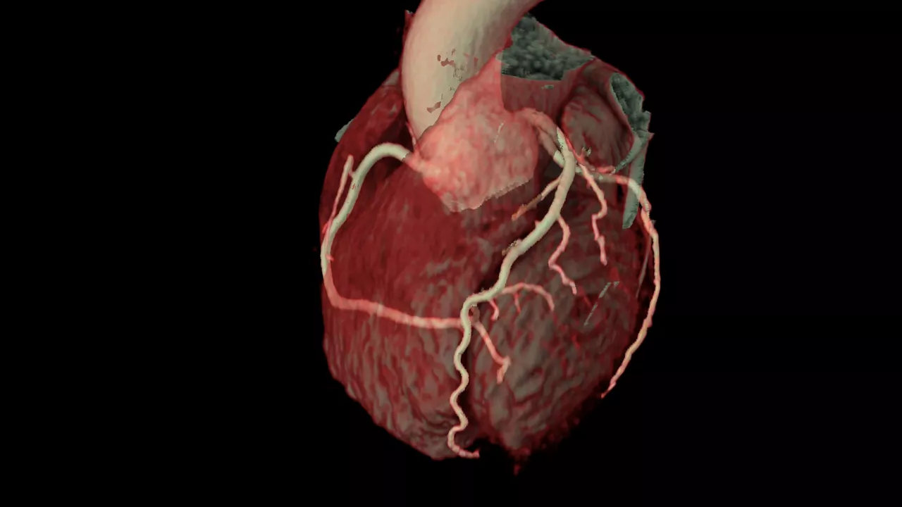 4-ecg-less-cardiac-ct-coronary-visualization
