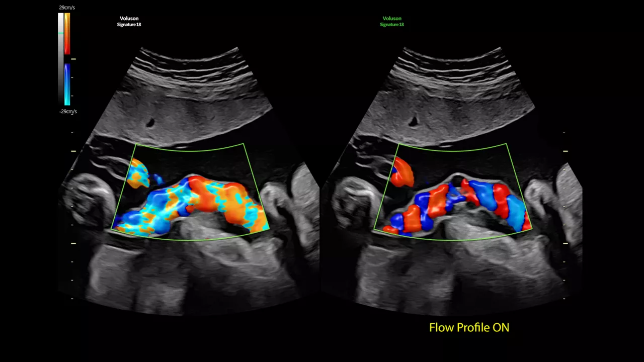 4-Flow-Profiles