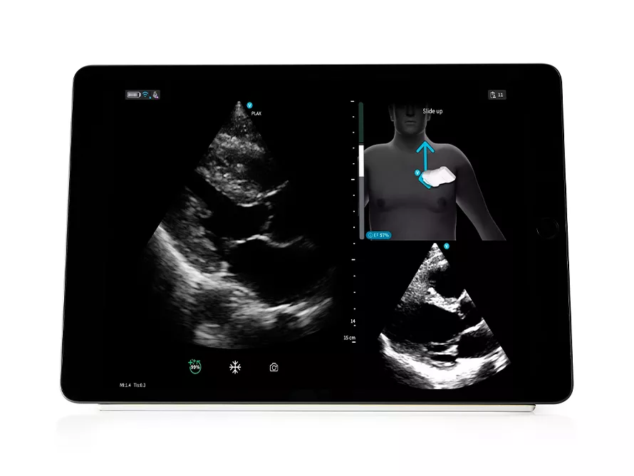41TabletPGuidance ScurveTablet890x668