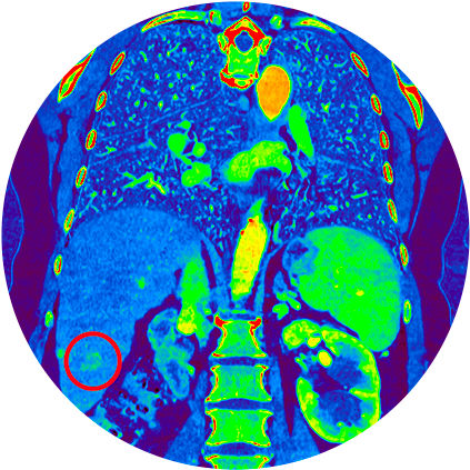 44650--truefidelity---generic-module-sitecore---featured-image