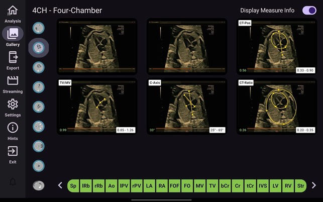 4ch-four-chamber-ci-en