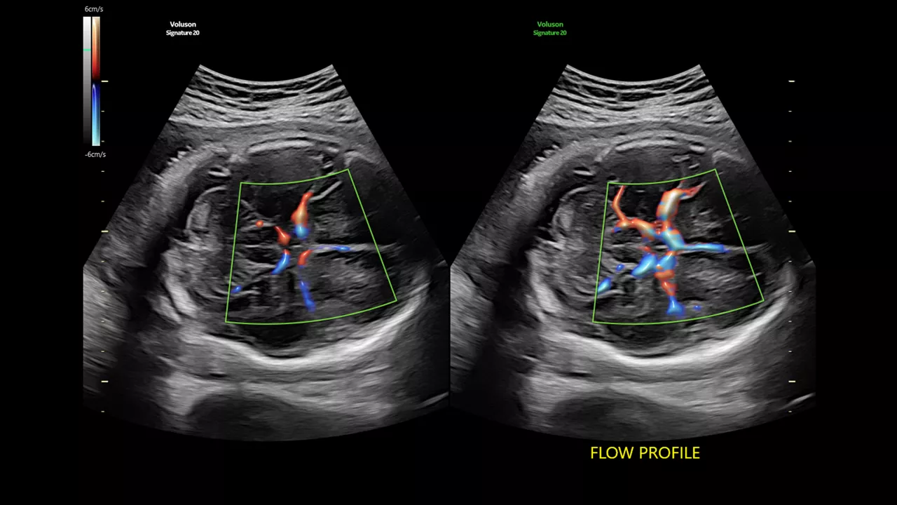 5-flow-profiles