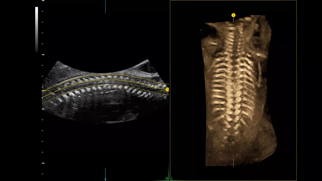 5-spine-trace-ci-en