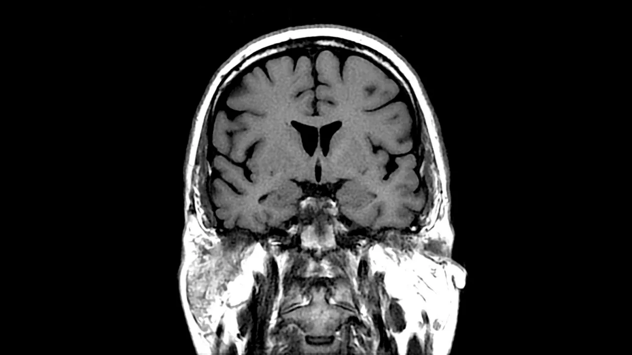 5twithgemsuite1clinicaloptimamr450wwithgemsuitebrainpropt1ex359clinical