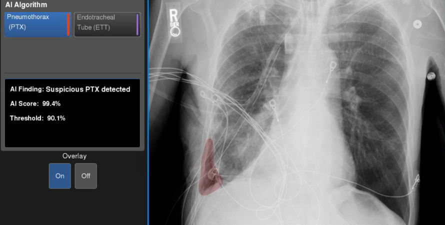 9-ptxoverlay890x450