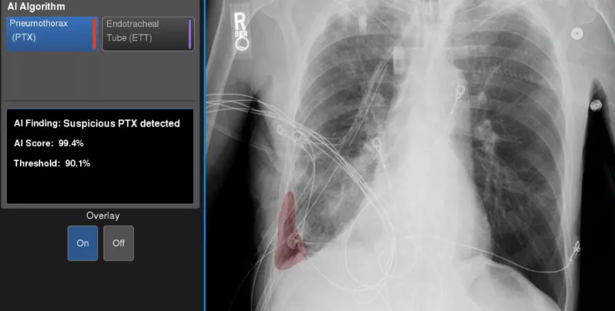 9-ptxoverlay890x450